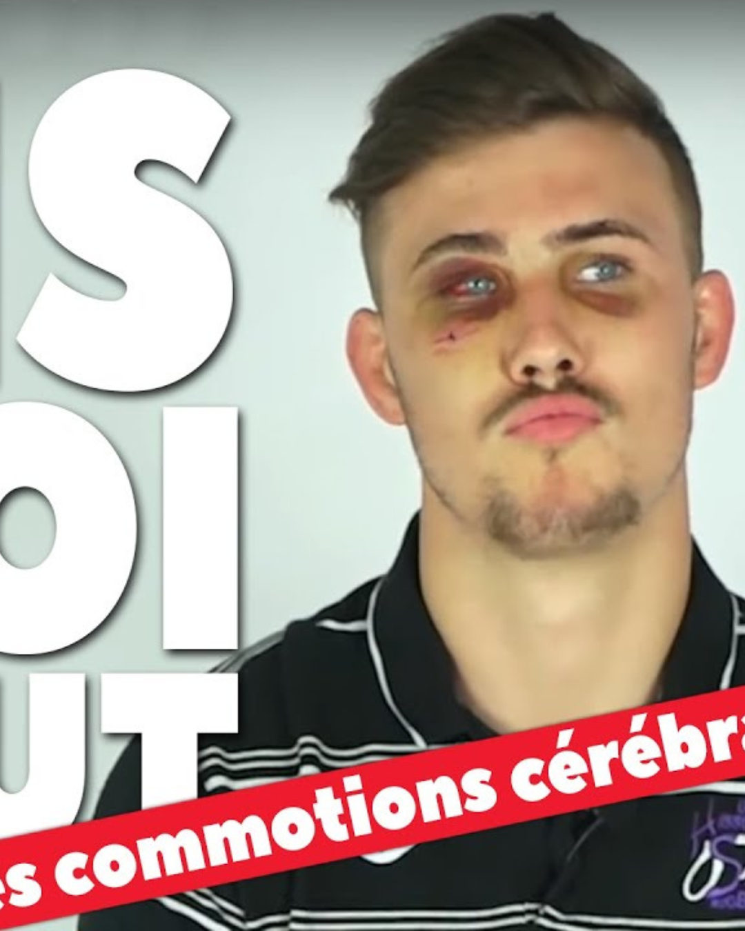  [ DIS MOI TOUT ] Les commotions cérébrales au rugby