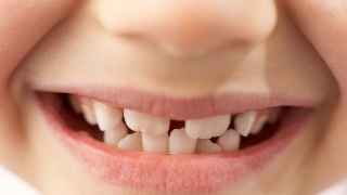 L'essentiel de l'orthodontie chez l’enfant