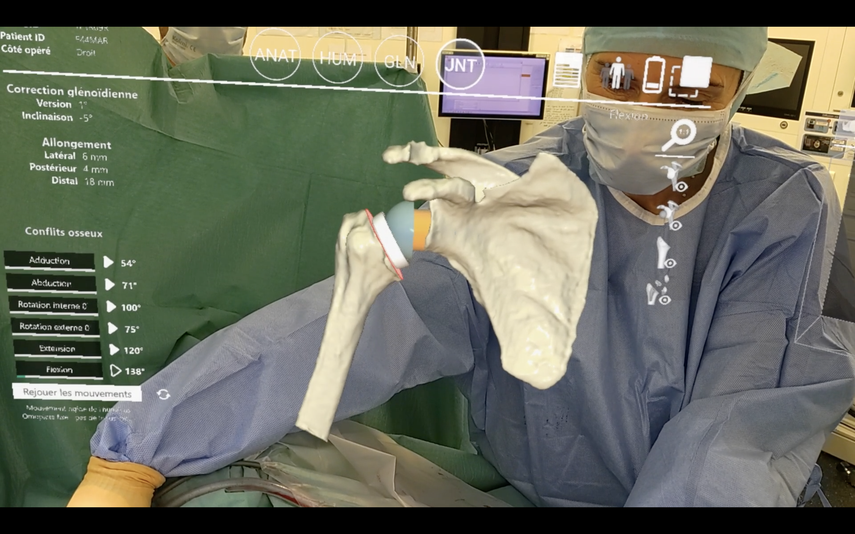 Chirurgie orthopédique en réalité augmentée à Nice
