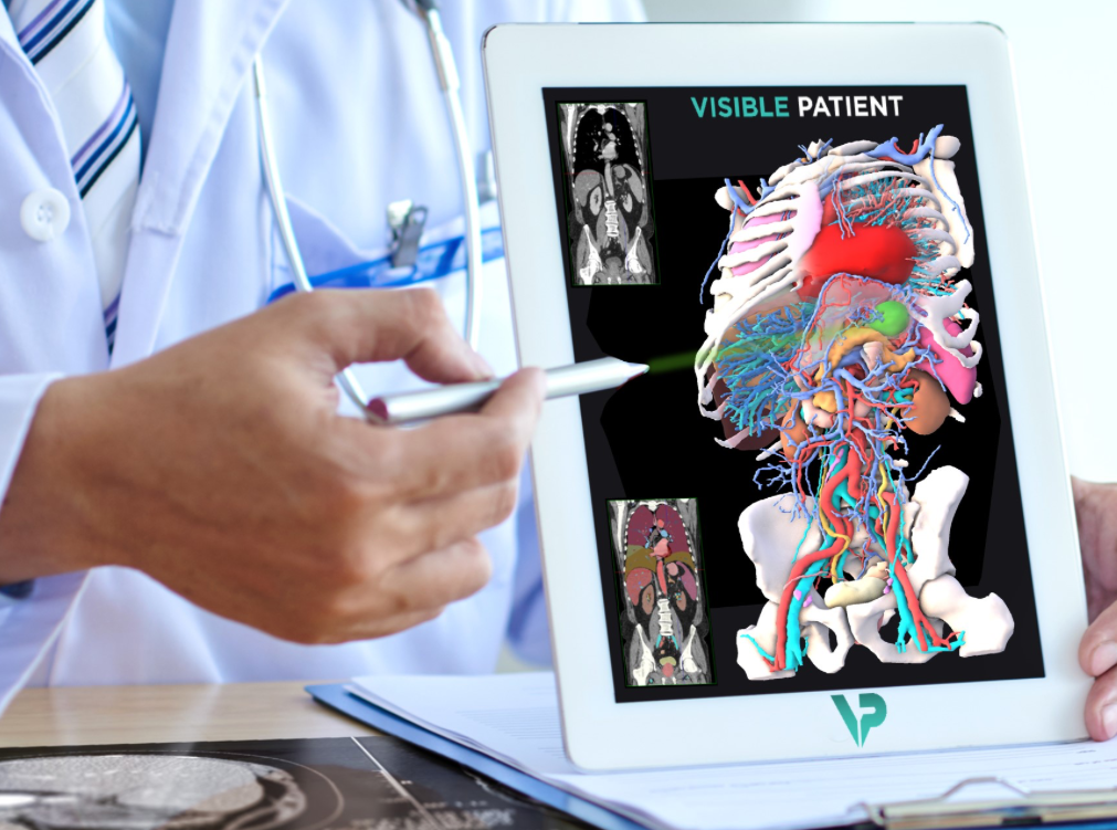 Des clones 3D virtuels au secours des interventions délicates