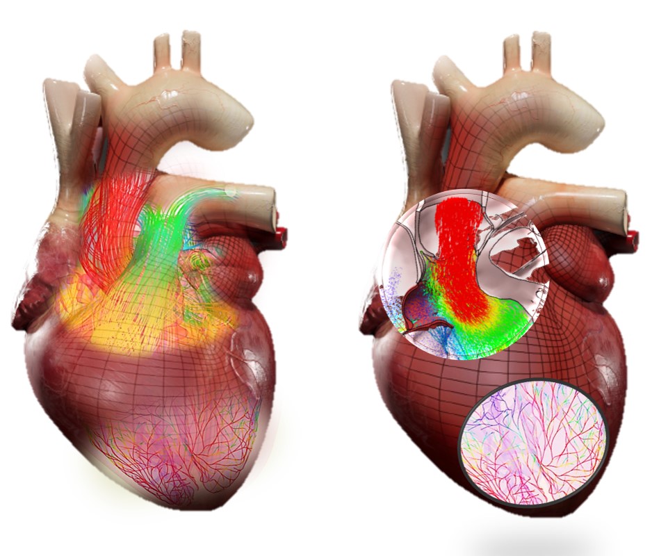 Un nouveau rythme pour Living Heart